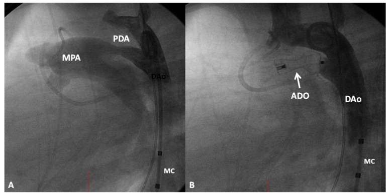 Figure 13