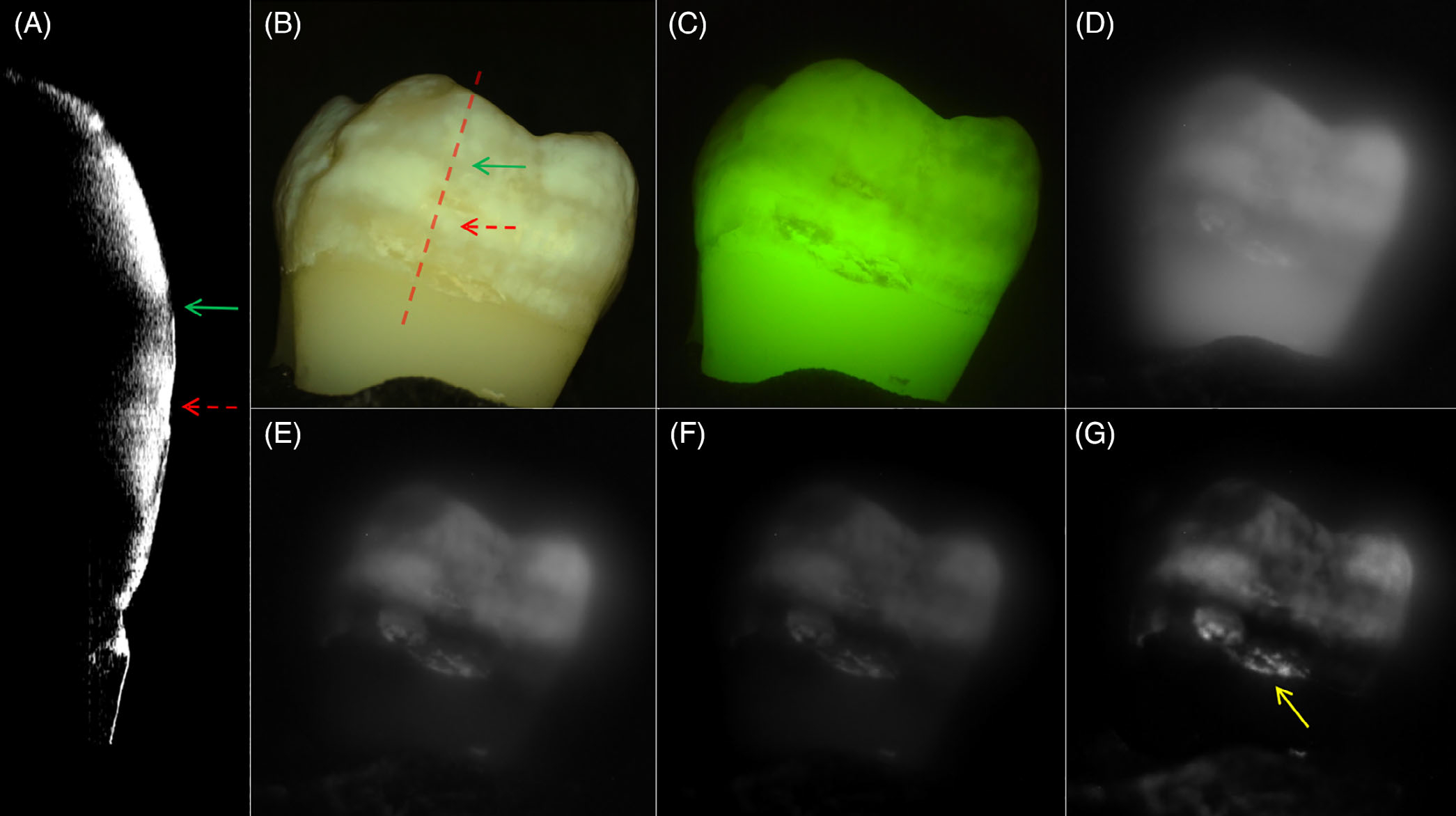 FIGURE 3