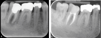 Fig. 22