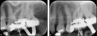 Fig. 19