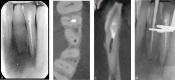 Fig. 18