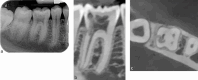 Fig. 12