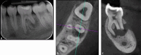 Fig. 9