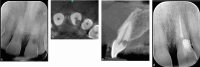 Fig. 13