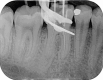 Fig. 17