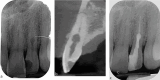 Fig. 14