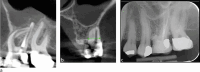Fig. 20