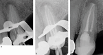 Fig. 16