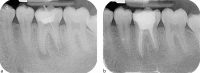 Fig. 21