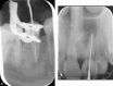 Fig. 15