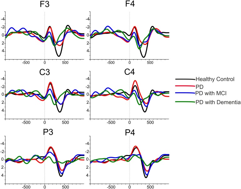 FIGURE 4