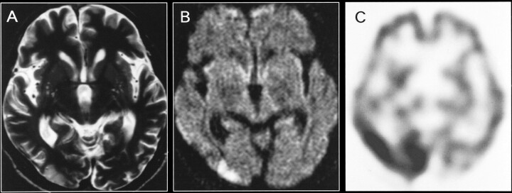 fig 3.