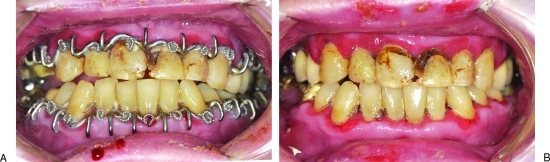 Figure 26