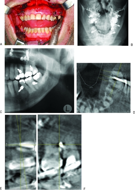 Figure 21