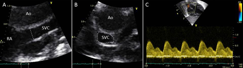 Figure 2