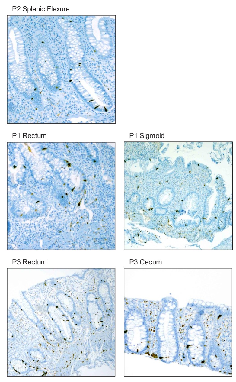 Figure 2—figure supplement 1.