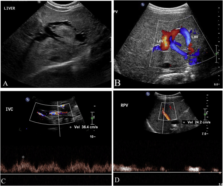 Fig. 1