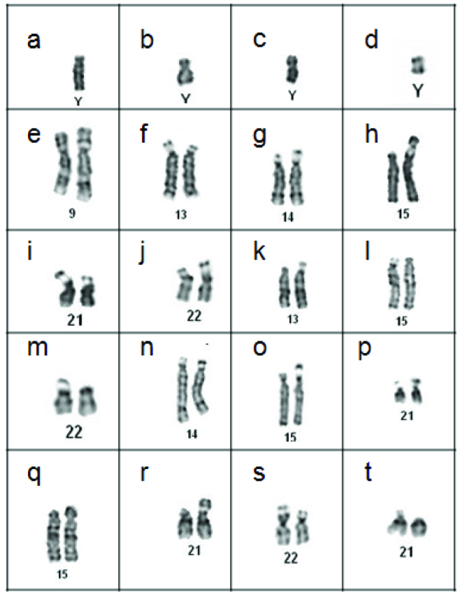 [Table/Fig-11]: