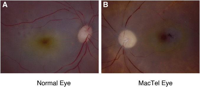 Fig. 4