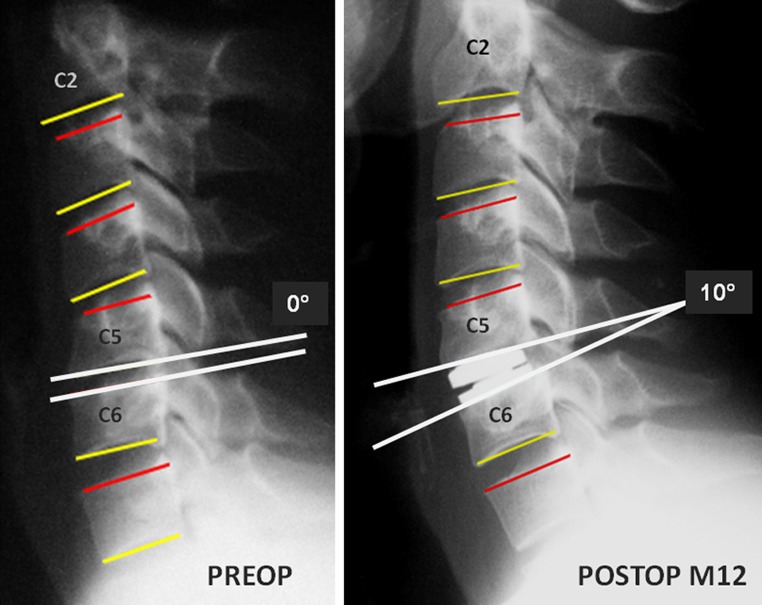 Fig. 6