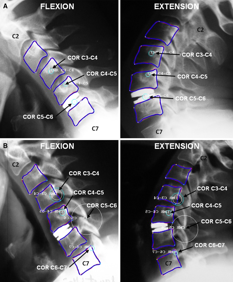 Fig. 10