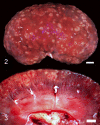 Figure 2 and 3
