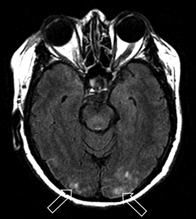 Fig 2.