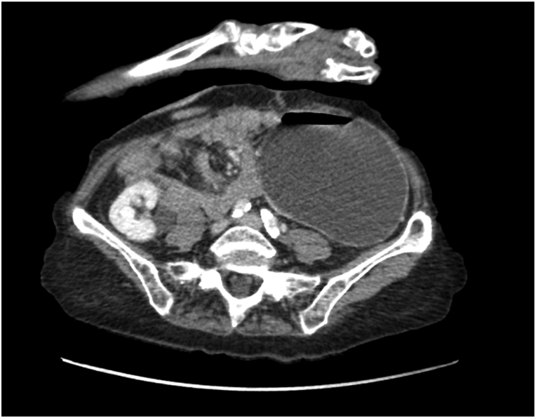 Figure 2 
