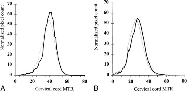 fig 3.