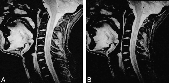 fig 2.