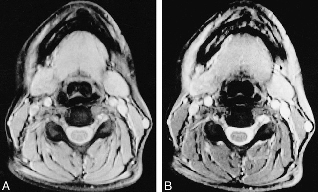 fig 1.