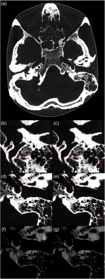 Fig. 6