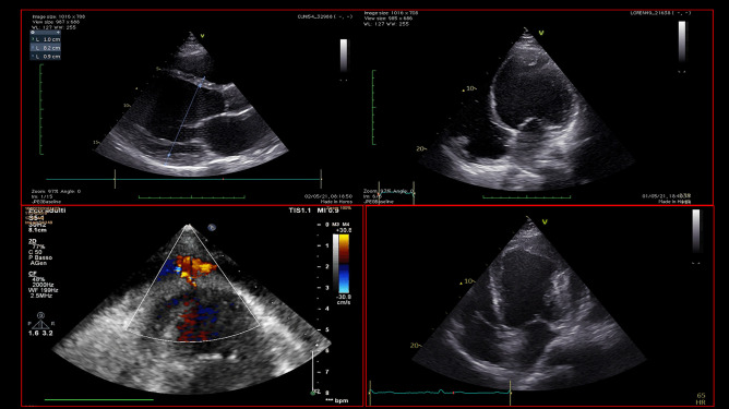 Fig. 4