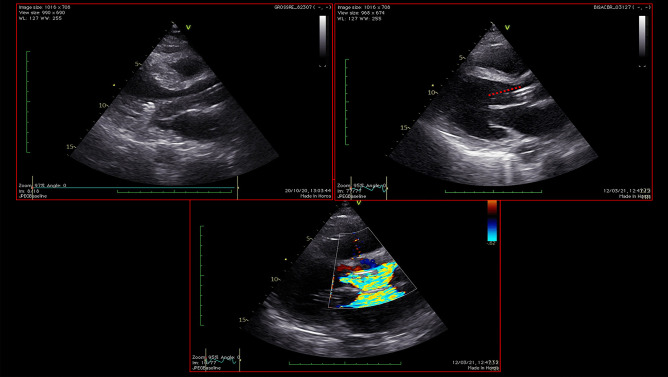 Fig. 6