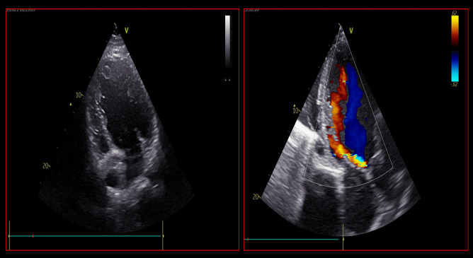 Fig. 5