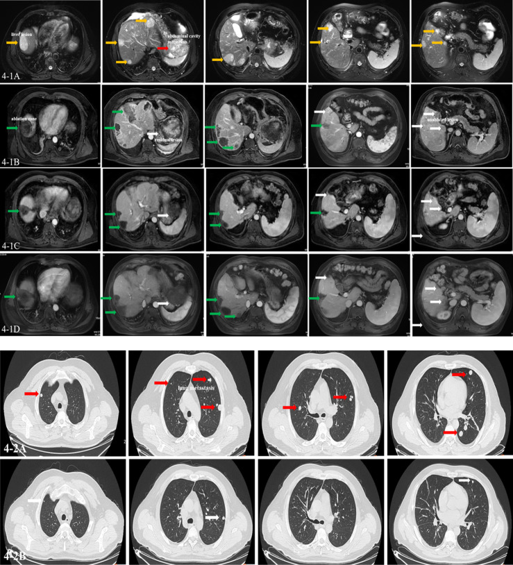 Figure 4