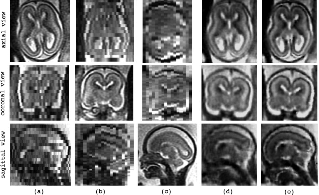 Fig. 10