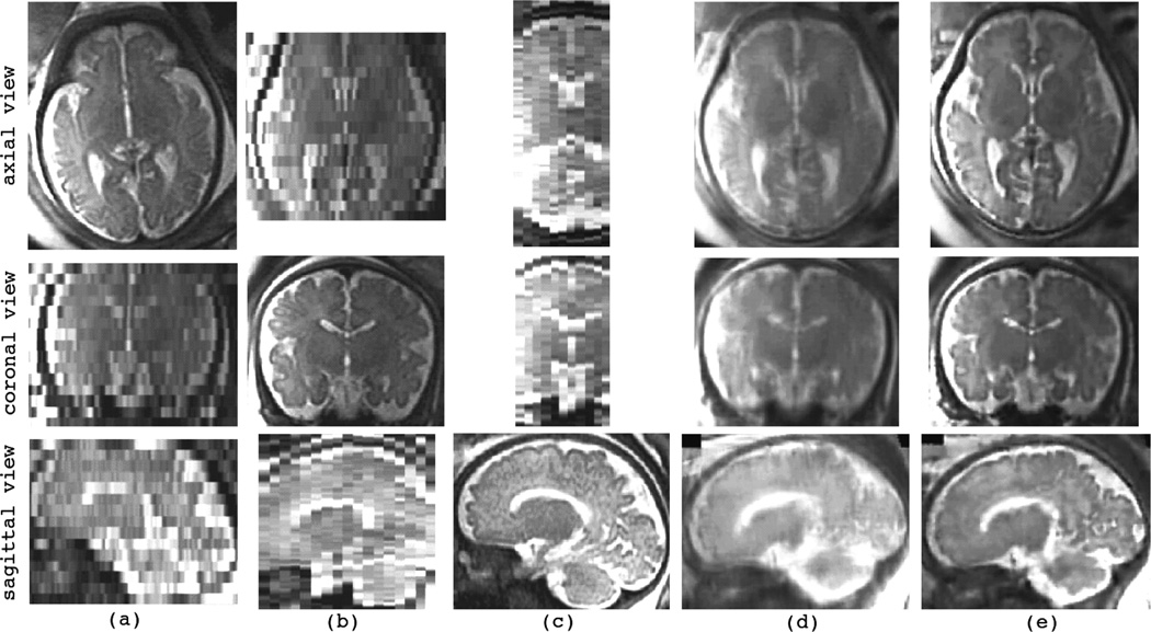 Fig. 11