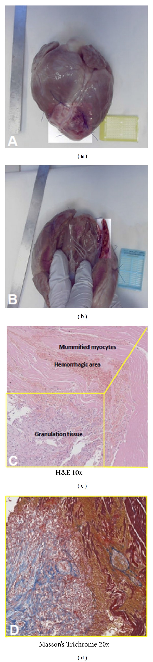 Figure 4