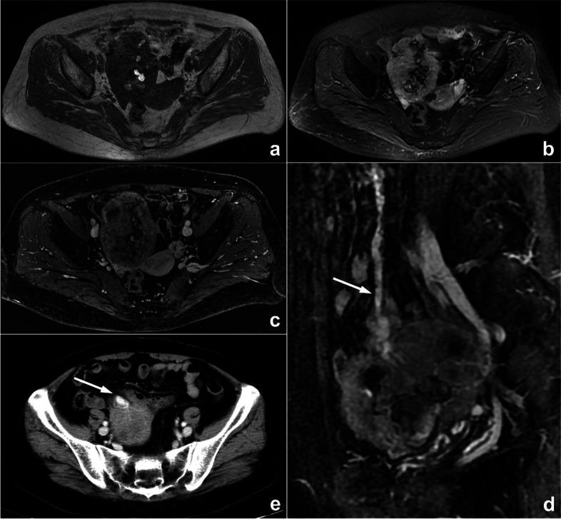 Fig. 10