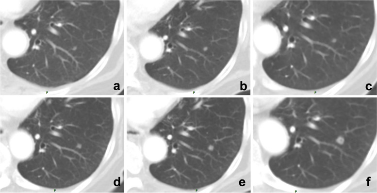 Fig. 6