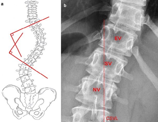 Fig. 2