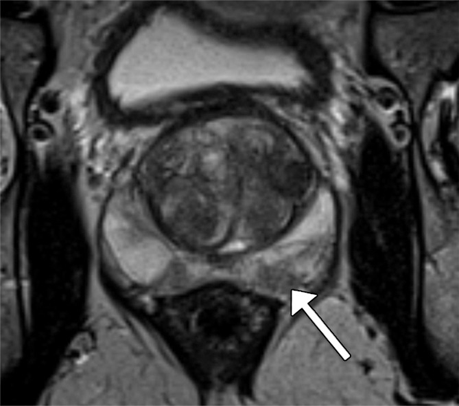 Figure 2a: