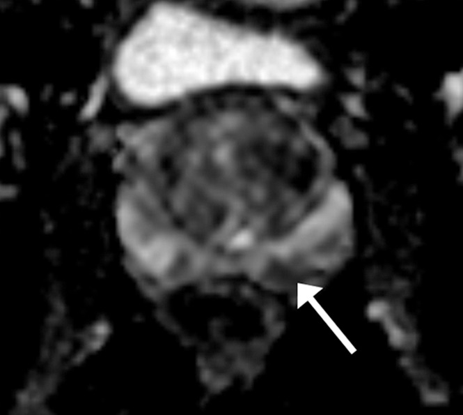 Figure 2c: