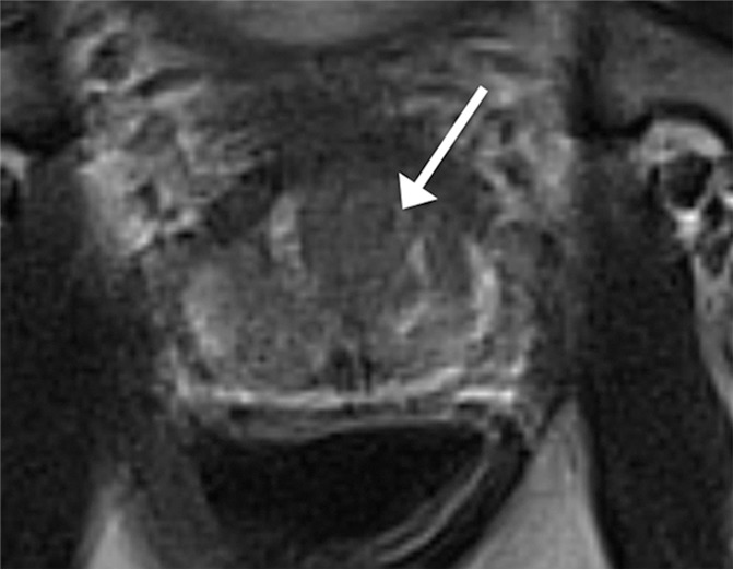 Figure 1a: