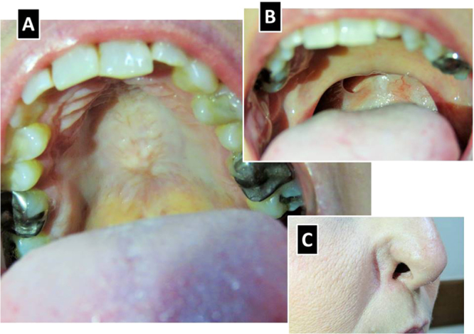 Fig. 6