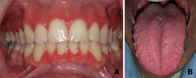 Fig. 2