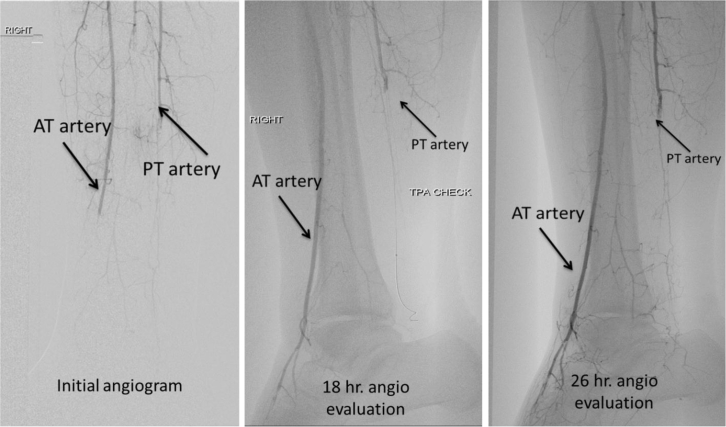 Fig 1