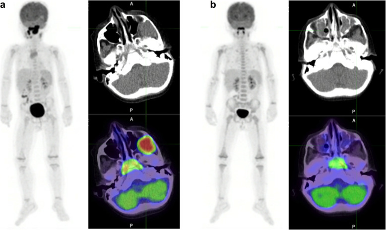 Fig. 9