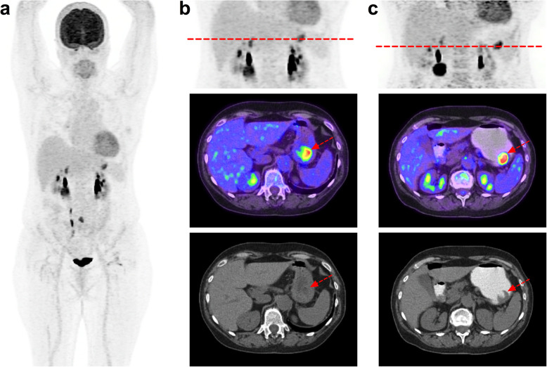 Fig. 4